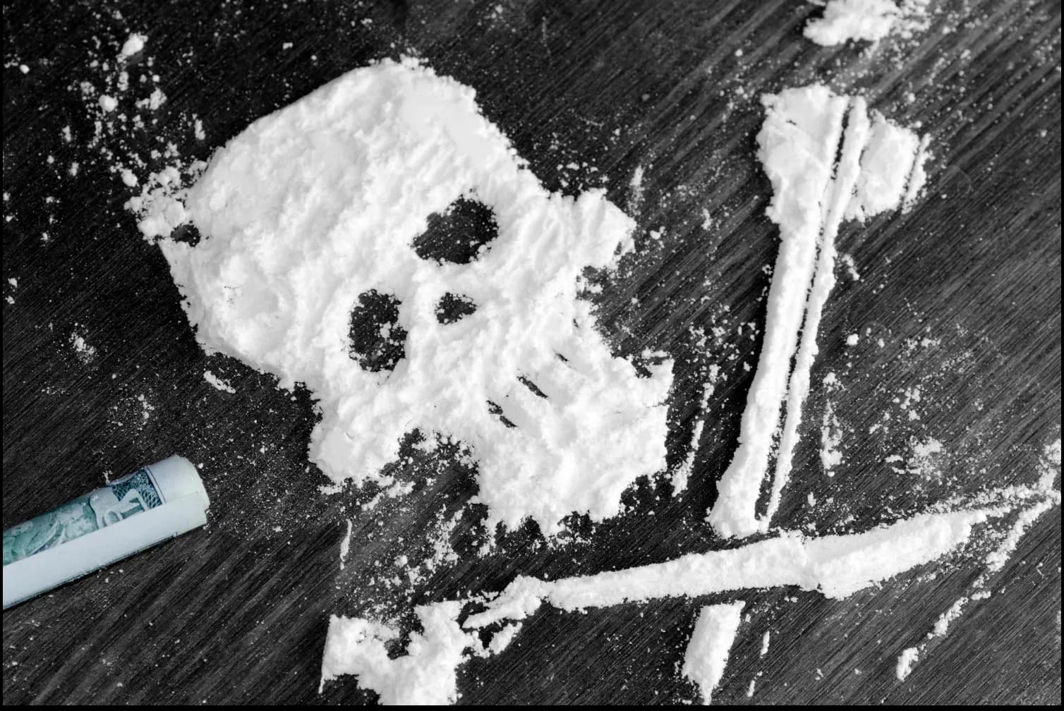 Cover image for What Does Cocaine Do to Your Brain?